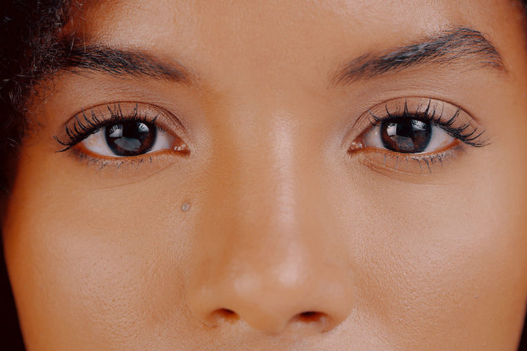 Eyelid Surgery (Blepharoplasty) in New Jersey | Dr. Deepak Ramesh