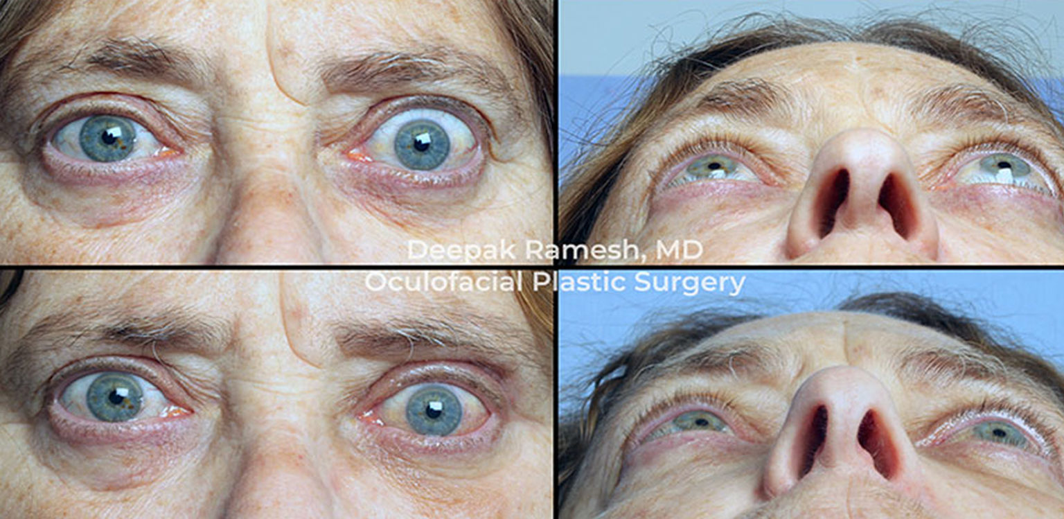 Orbital Center for Eye and Facial Plastic Surgery