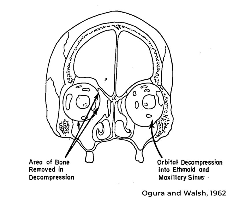 Orbital Near Me Center for Eye & Facial Plastic Surgery