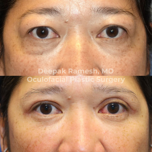 Orbital Center for Eye and Facial Plastic Surgery