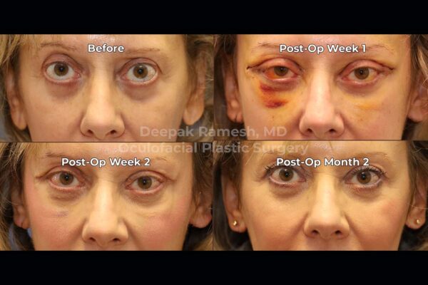 OD 2 timeline OD 2 timeline