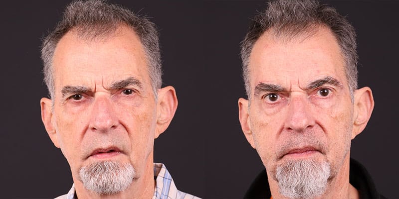Male Surgery